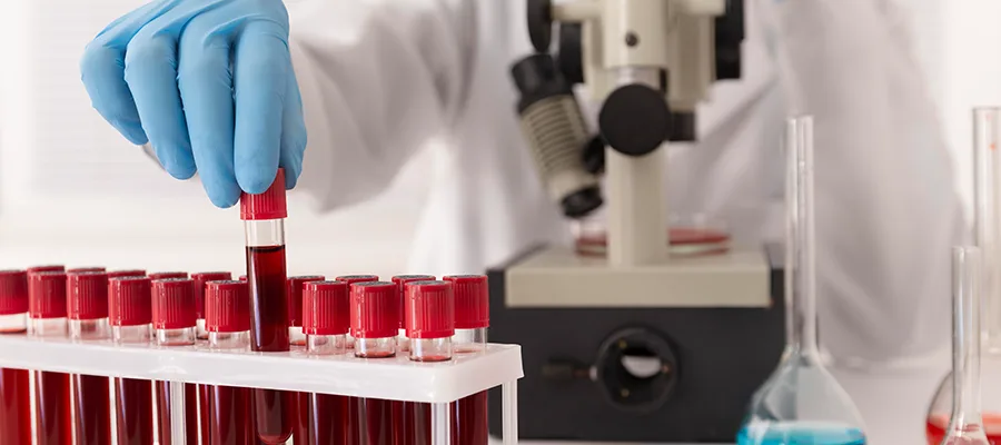 Home blood sample collection